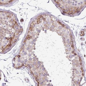 Anti-PARD6A antibody produced in rabbit 