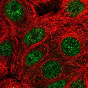 Anti-PARG antibody produced in rabbit 