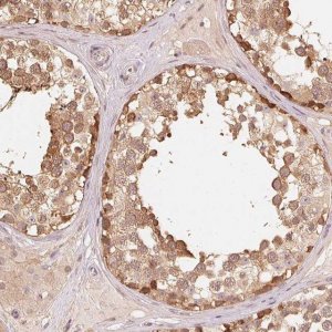 Anti-PARK2 antibody produced in rabbit 