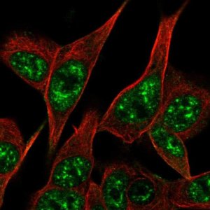 Anti-PARK2 antibody produced in rabbit 