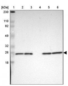 Anti-PARK7 antibody produced in rabbit 