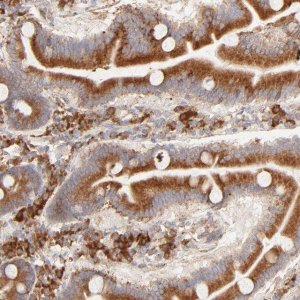 Anti-PARP12 antibody produced in rabbit 