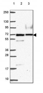 Anti-PARP3 antibody produced in rabbit 