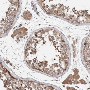 Anti-PARP6 antibody produced in rabbit 