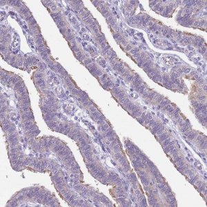 Anti-PARP8 antibody produced in rabbit 