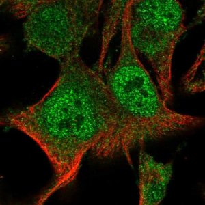 Anti-PARP9 antibody produced in rabbit 