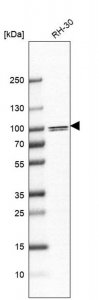 Anti-PARP9 antibody produced in rabbit 