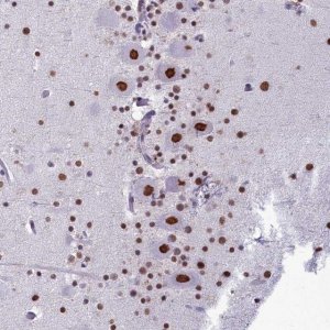 Anti-PARPBP antibody produced in rabbit 