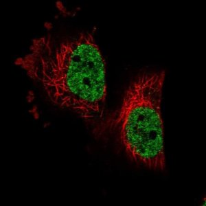 Anti-PARPBP antibody produced in rabbit 