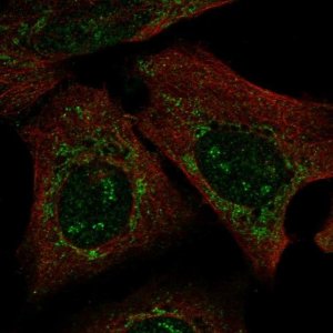 Anti-PARS2 antibody produced in rabbit 