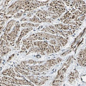 Anti-PARVA antibody produced in rabbit 