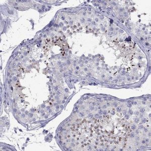 Anti-PATE1 antibody produced in rabbit 