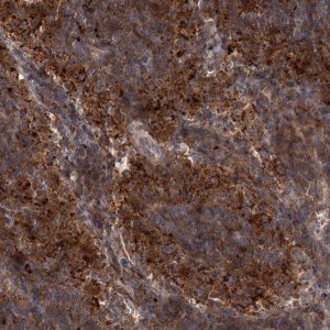 Anti-PATL1 antibody produced in rabbit 