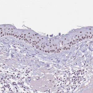 Anti-PAX3 antibody produced in rabbit 