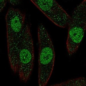 Anti-PAX8 antibody produced in rabbit 