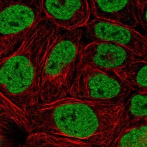 Anti-PBRM1 antibody produced in rabbit 