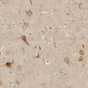 Anti-PCDH19 antibody produced in rabbit 