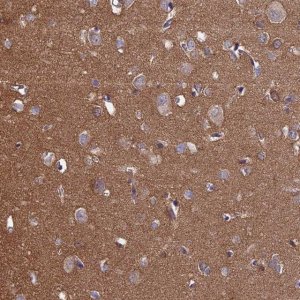 Anti-PCDHA5 antibody produced in rabbit 