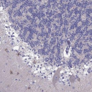 Anti-PCDHA6 antibody produced in rabbit 