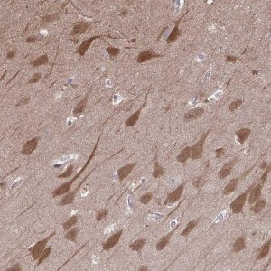 Anti-PCDHB7 antibody produced in rabbit 