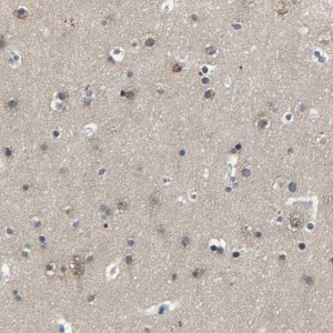 Anti-PCNX2 antibody produced in rabbit 