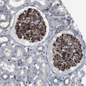 Anti-PCOLCE2 antibody produced in rabbit 
