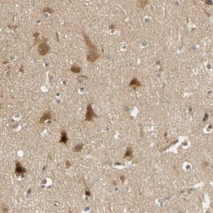Anti-PDDC1 antibody produced in rabbit 