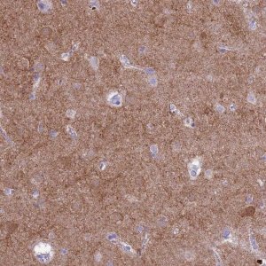 Anti-PDE10A antibody produced in rabbit 