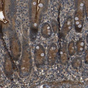 Anti-PDE5A antibody produced in rabbit 