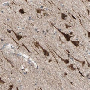 Anti-PDE8A antibody produced in rabbit 