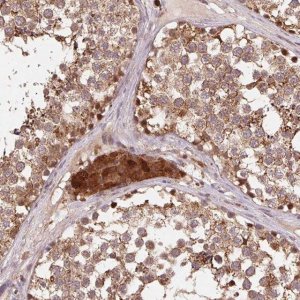 Anti-PDHA1 antibody produced in rabbit 