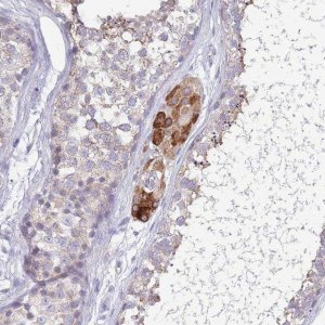 Anti-PDHA1 antibody produced in rabbit HPA047864-100UL