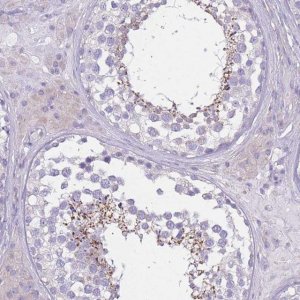 Anti-PDHA2 antibody produced in rabbit 