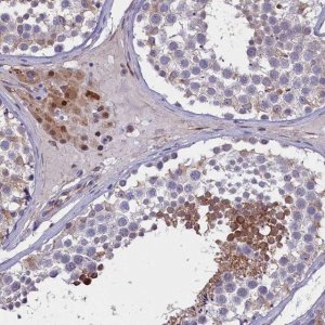 Anti-PDILT antibody produced in rabbit 