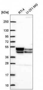 Anti-PDK3 antibody produced in rabbit 