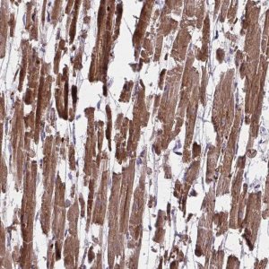 Anti-PDK4 antibody produced in rabbit 