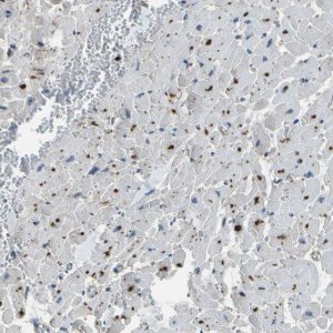Anti-PDLIM1 antibody produced in rabbit HPA017010-100UL