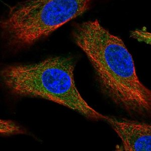 Anti-PDSS1 antibody produced in rabbit 
