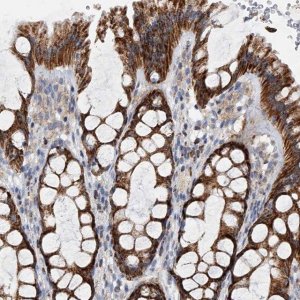 Anti-PDSS2 antibody produced in rabbit 