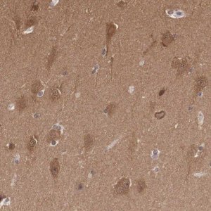 Anti-PDXP antibody produced in rabbit 