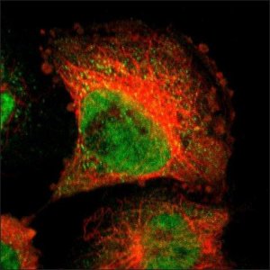 Anti-PDXP antibody produced in rabbit HPA001099-100UL