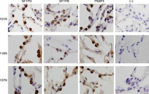 Anti-PEBP4 antibody produced in rabbit 