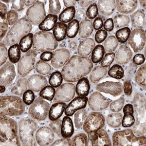 Anti-PEBP4 antibody produced in rabbit 
