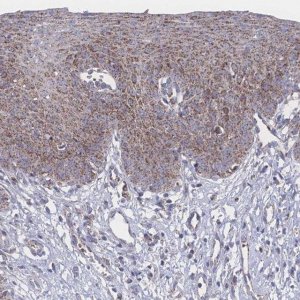 Anti-PEX14 antibody produced in rabbit 