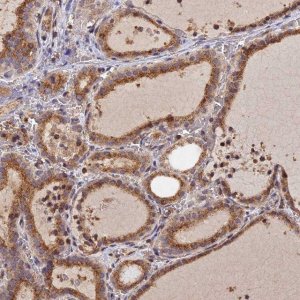 Anti-PEX3 antibody produced in rabbit 