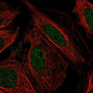 Anti-PFKFB2 antibody produced in rabbit 