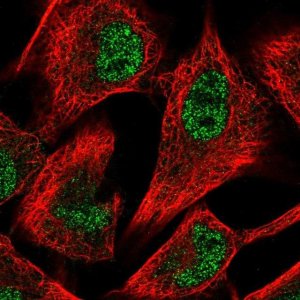 Anti-PFKFB3 antibody produced in rabbit 
