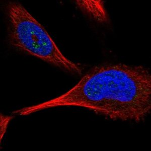 Anti-PFKFB4 antibody produced in rabbit 
