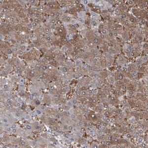 Anti-PFKL antibody produced in rabbit 