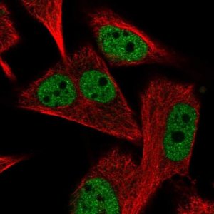Anti-PGAM2 antibody produced in rabbit 